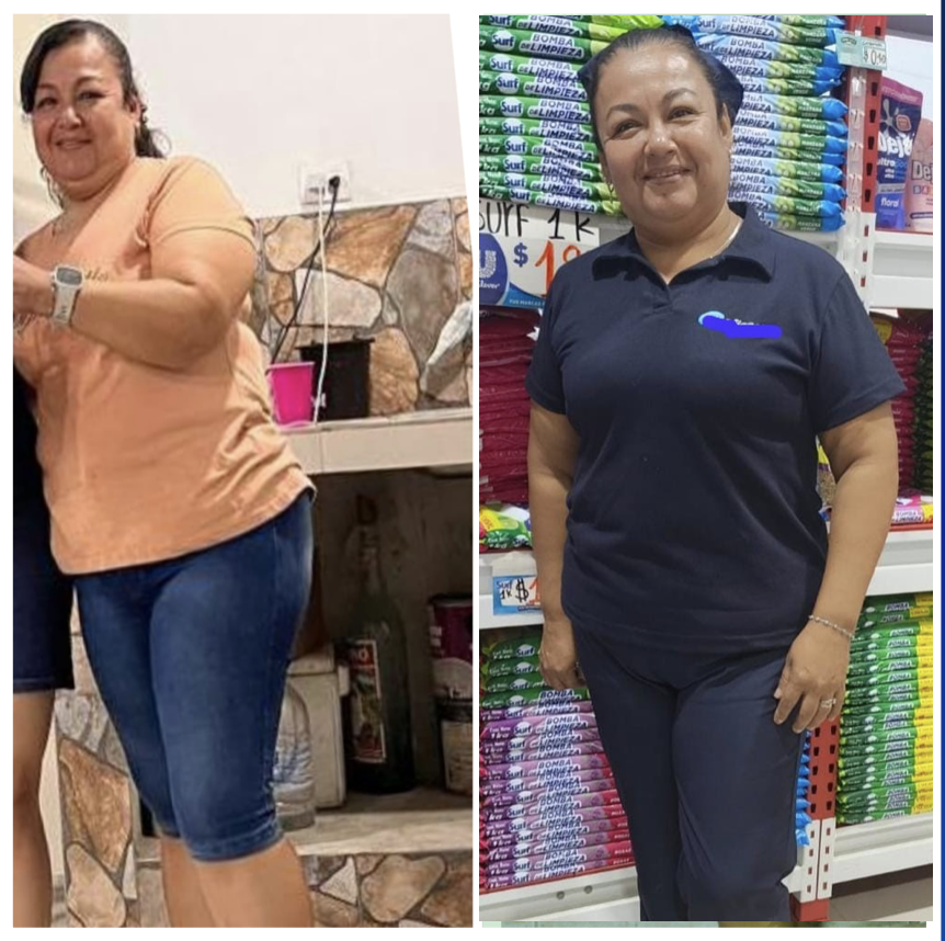 Johana Macías antes y después