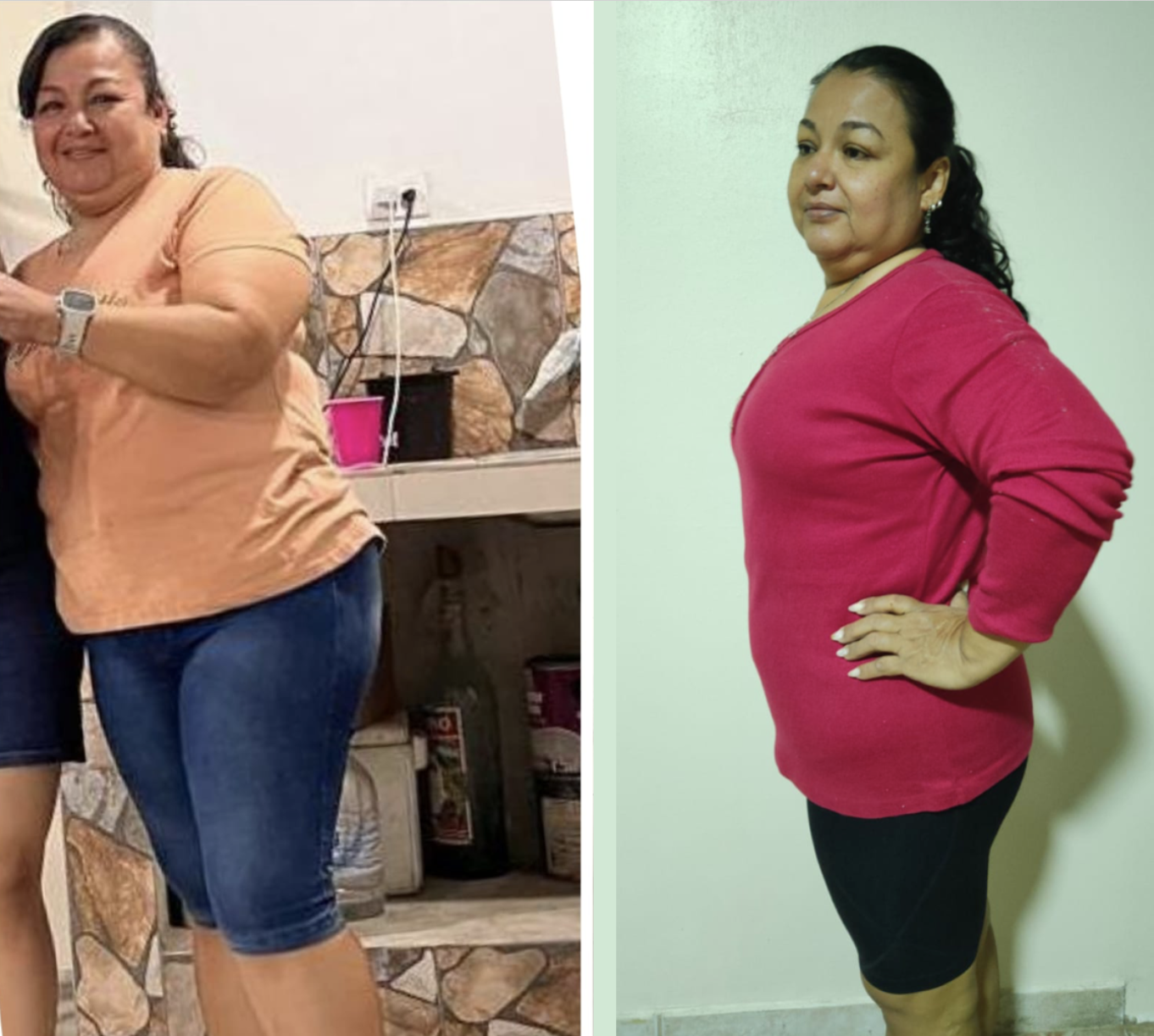 Johana Macías antes y después