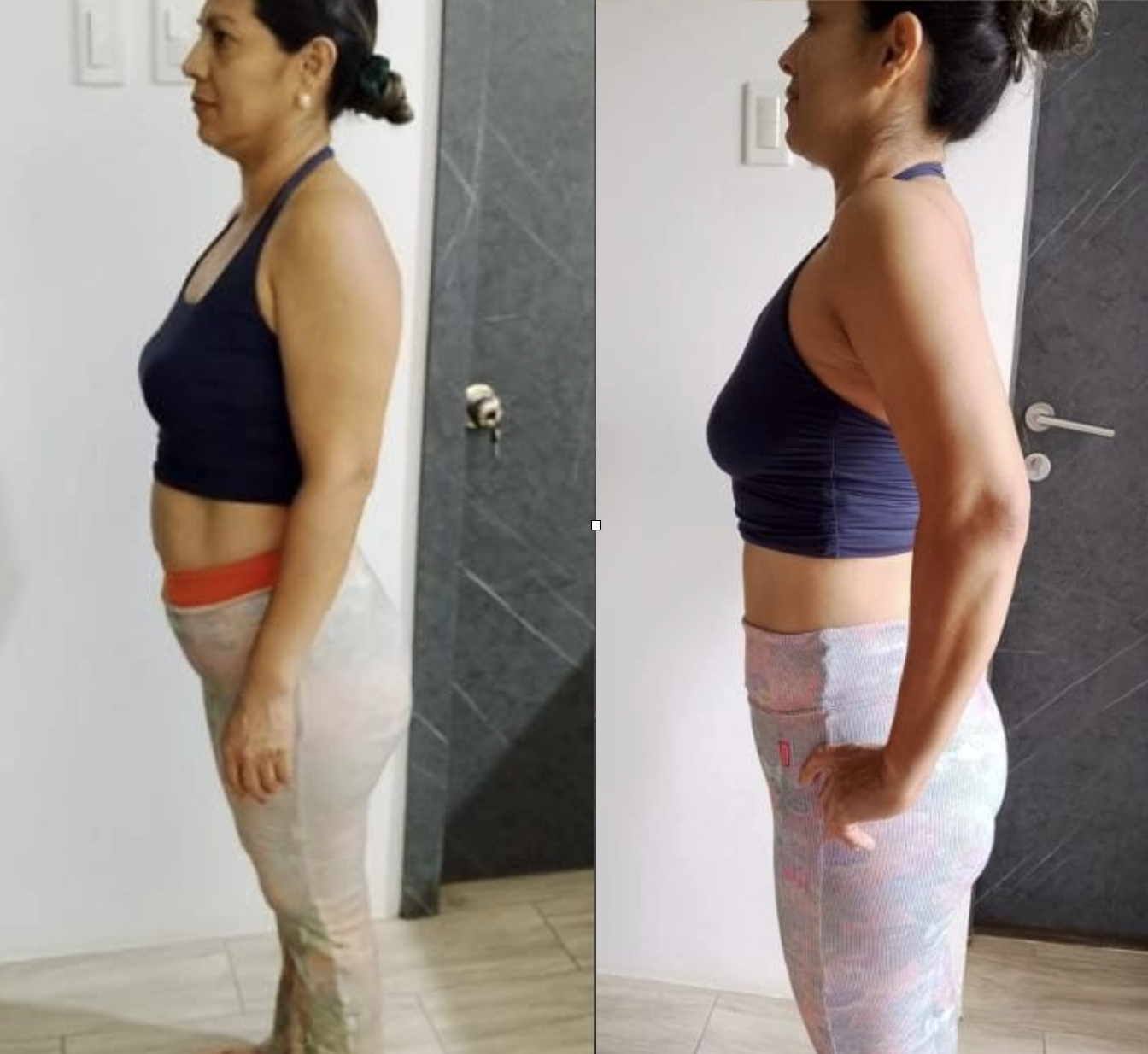 Mariuxi Palma antes y después