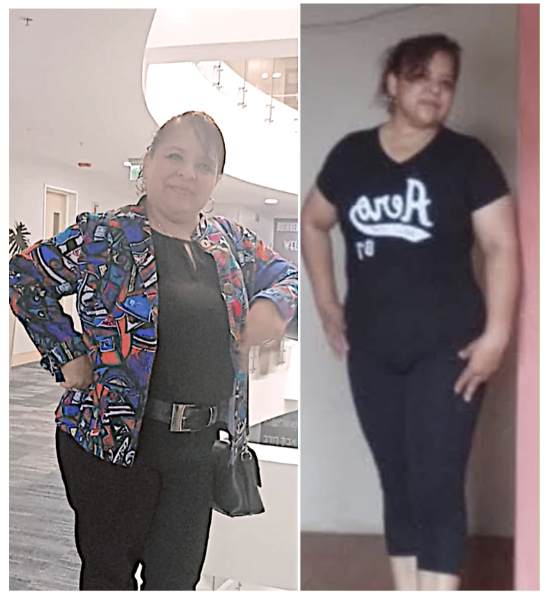 Nancy Moncerrate antes y después