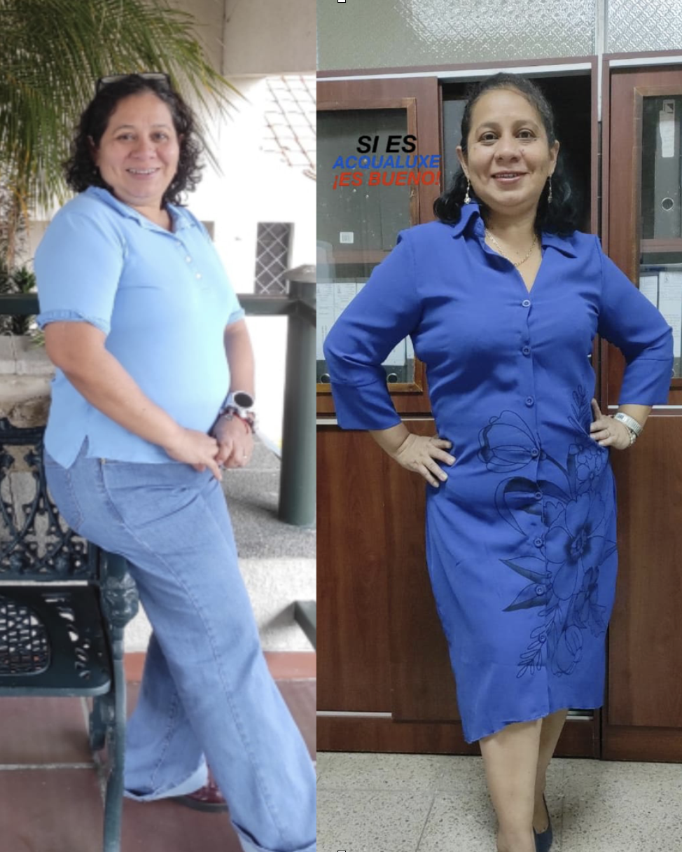 Sinthia Mera antes y después